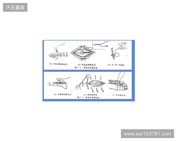 广州豹官方：杨浩眉弓伤口缝合30余针，预计5-7天后拆线